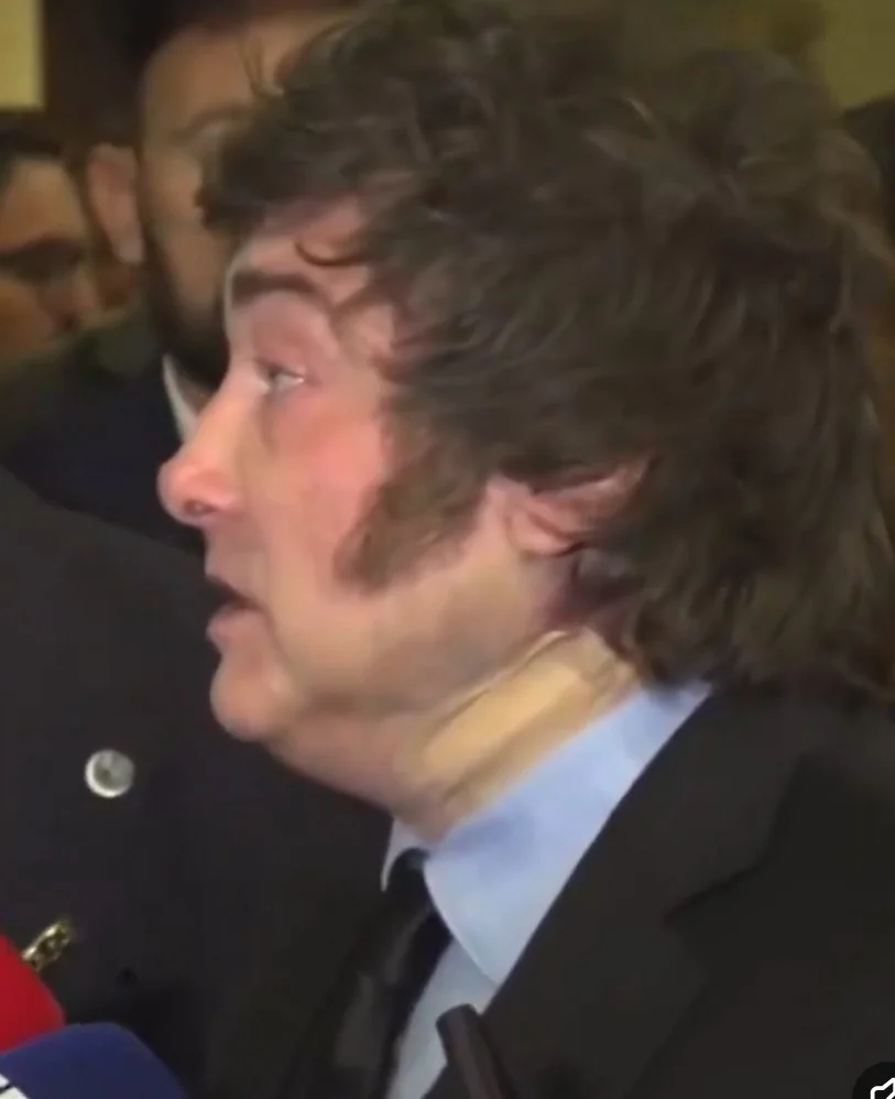 Llamo la atención el parche en el cuello del presidente Milei